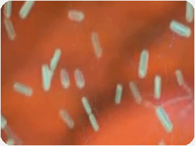 the fungal hypothesis