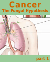 fungal hypothesis