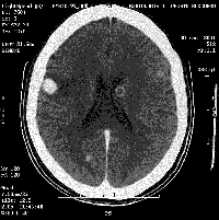 cm-3